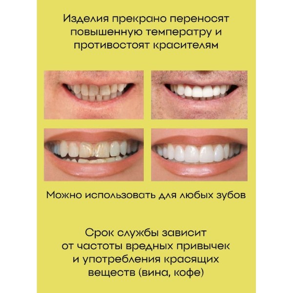 Виниры для зубов Perfect smile veneers 2 шт (Белый)