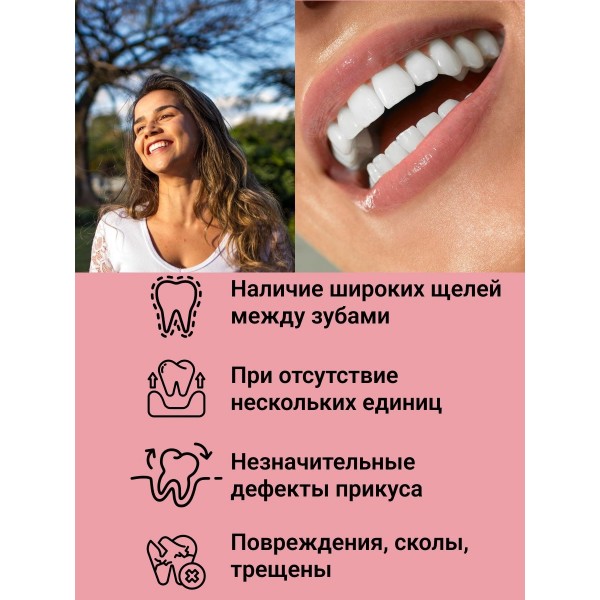 Виниры для зубов Snapon Smile 2 шт (Белый)