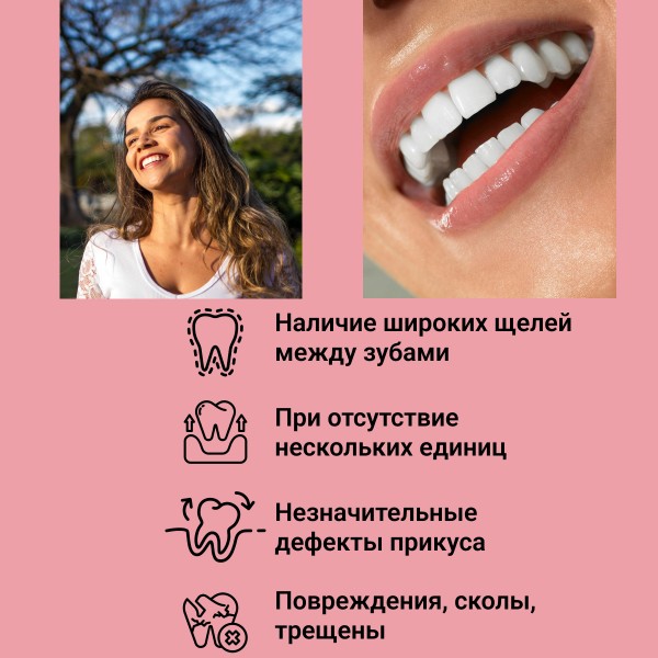 Виниры для зубов Snapon Smile (Белый)