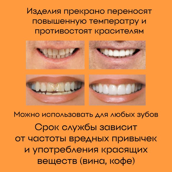Виниры для зубов Perfect smile veneers (Белый)